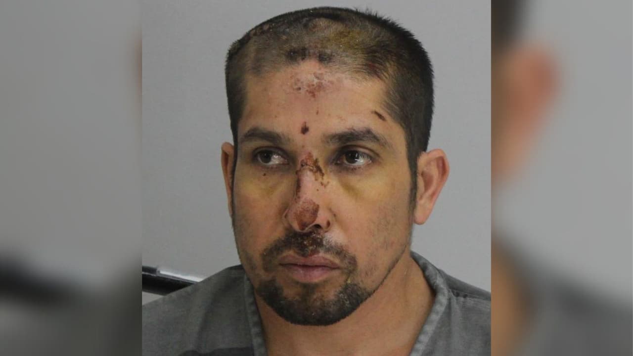 Jaime Jaramillo salió del hospital y le fue fijada una fianza de 2 millones de dólares por ser el sospechoso de disparar al policía de Mesquite.