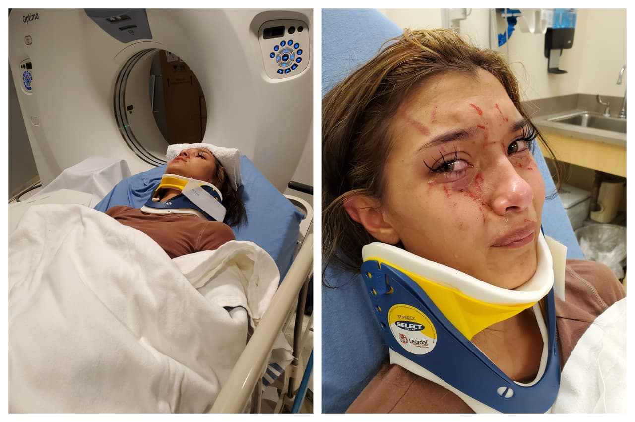 "Nadie hizo nada", denuncia madre de una chica agredida por una amiga de su escuela en Texas