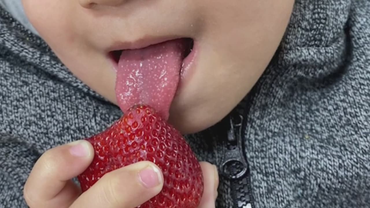 Autoridades de salud vigilan posible aumento de fiebre escarlatina en el DMV: conoce sus síntomas