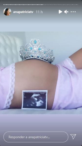 Ana Patricia quiso fotografiarse con el ultrasonido, su abdomen de embarazada y una corona, que llevó a sus fans a recordar el paso de la mexicana por Nuestra Belleza Latina.