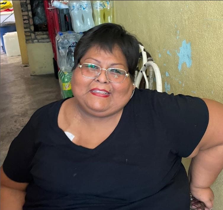 La mamá de Iker padece riñones poliquísticos hereditarios.