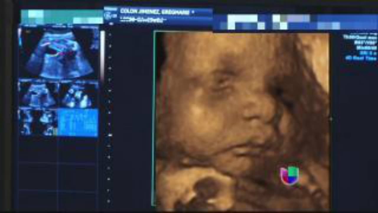 Así se vio baby Kamilia en la barriguita de su mami.