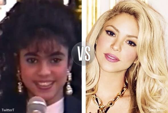 Shakira puede parecer muy natural, pero con el tiempo se ha hecho algunos ajustes a su bella cara.