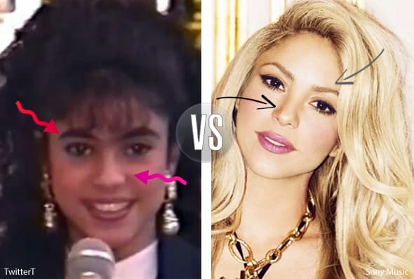 Por ejemplo, se sacó las cejas, su sonrisa se ve más blanca y la nariz no se ve igual antes que ahora, ¿rinoplastía? ¿Tú qué opinas?