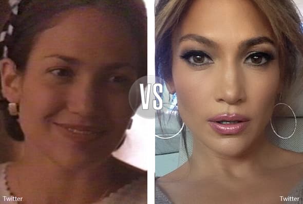 Jennifer Lopez es una de las mujeres más envidiadas por lucir radiante a sus 45 años, pero a pesar de que hace mucho ejercicio, parece que se ha ayudado con otros métodos.