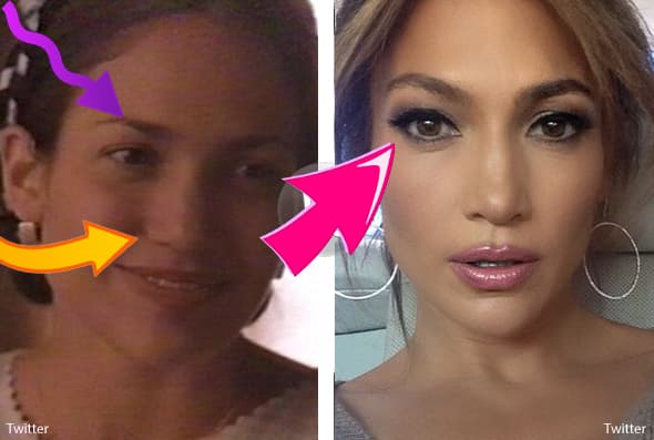 Un médico del Reino Unido aseguró en Twitter que la estrella tiene muchos signos de cirugía plástica.