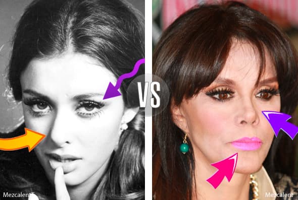 Entre los rasgos que le han cambiado a Lucía se encuentran los ojos, labios y nariz.