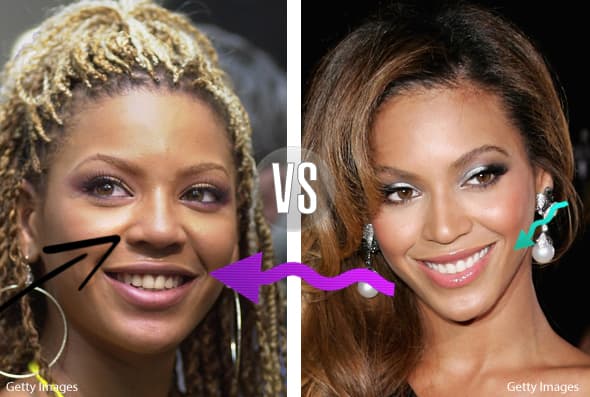 La nariz se ve más estilizada, la sonrisa más blanca y pareja y el rostro más afilado.