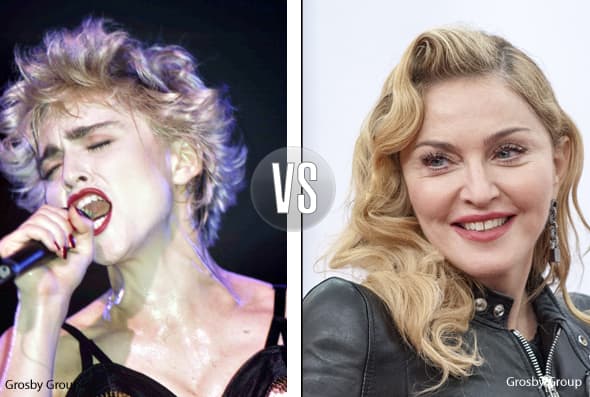 Otra que dicen que es mega adicta a las cirugías plásticas y tratamientos estéticos es Madonna.