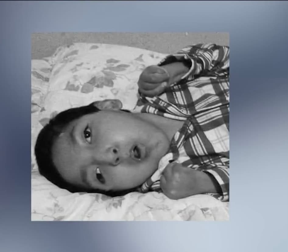 La mujer, sumida en la pobreza, cuenta que desde muy pequeño le detectaron a su nieto hidrocefalia, por lo que tuvo que hacerse cargo de él, sobre todo después de que su hijo y su nuera lo abandonaran al colapsar en el fatídico mundo de las drogas.
<br>