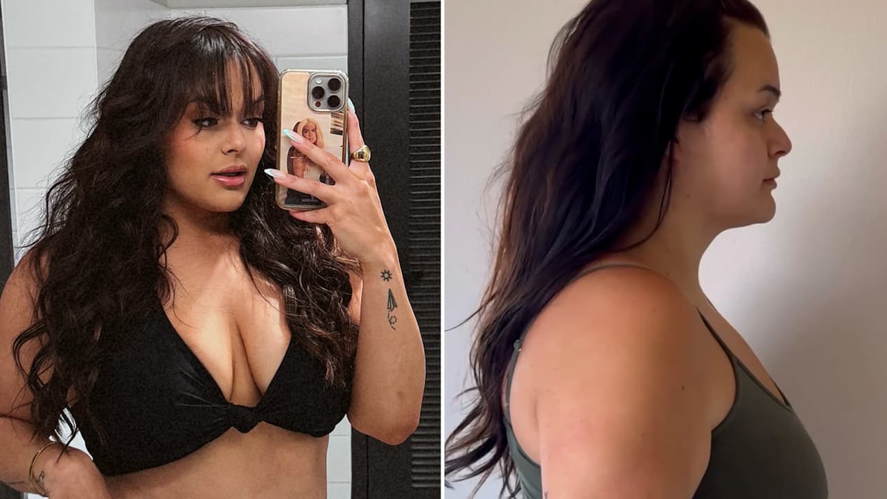 “Firmes" y "levantados”: Jenicka López presume el 'antes' y 'después' de su cirugía de senos