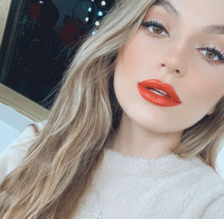 "Todo mundo me puso: '
<b><a href="https://www.univision.com/shows/despierta-america/inyecciones-cirugias-y-hasta-tratamientos-con-oro-o-champan-para-retrasar-los-efectos-de-la-edad-en-el-rostro-video" target="_blank">Te inyectaste los labios</a></b>, ¿qué te hiciste? ¿es el filtro?'", contó sobre los cuestionamientos que recibió a raíz de la imagen. 
<br>