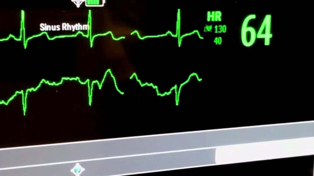 "Yo lo considero como un suicidio": Nueva York pone en marcha la ley de muerte asistida en medio de opiniones divididas