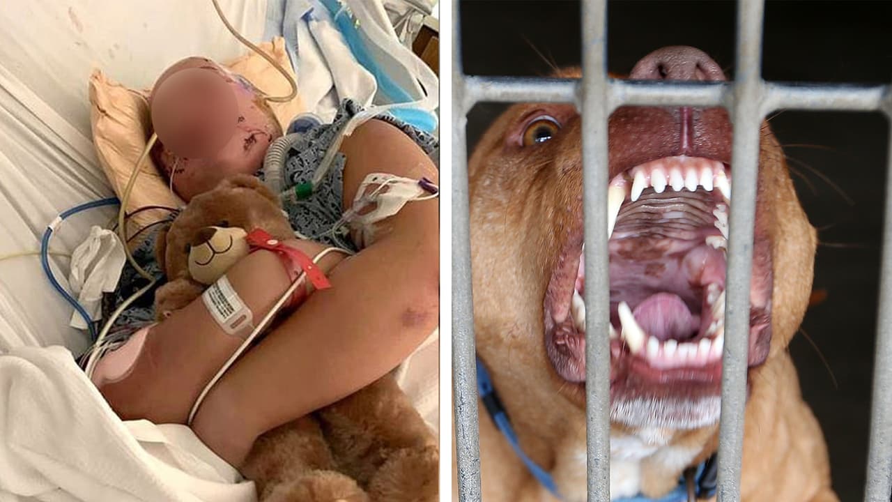 Tras 19 cirugías y 83 días en el hospital, adolescente atacada por dos perros pitbull regresa a casa