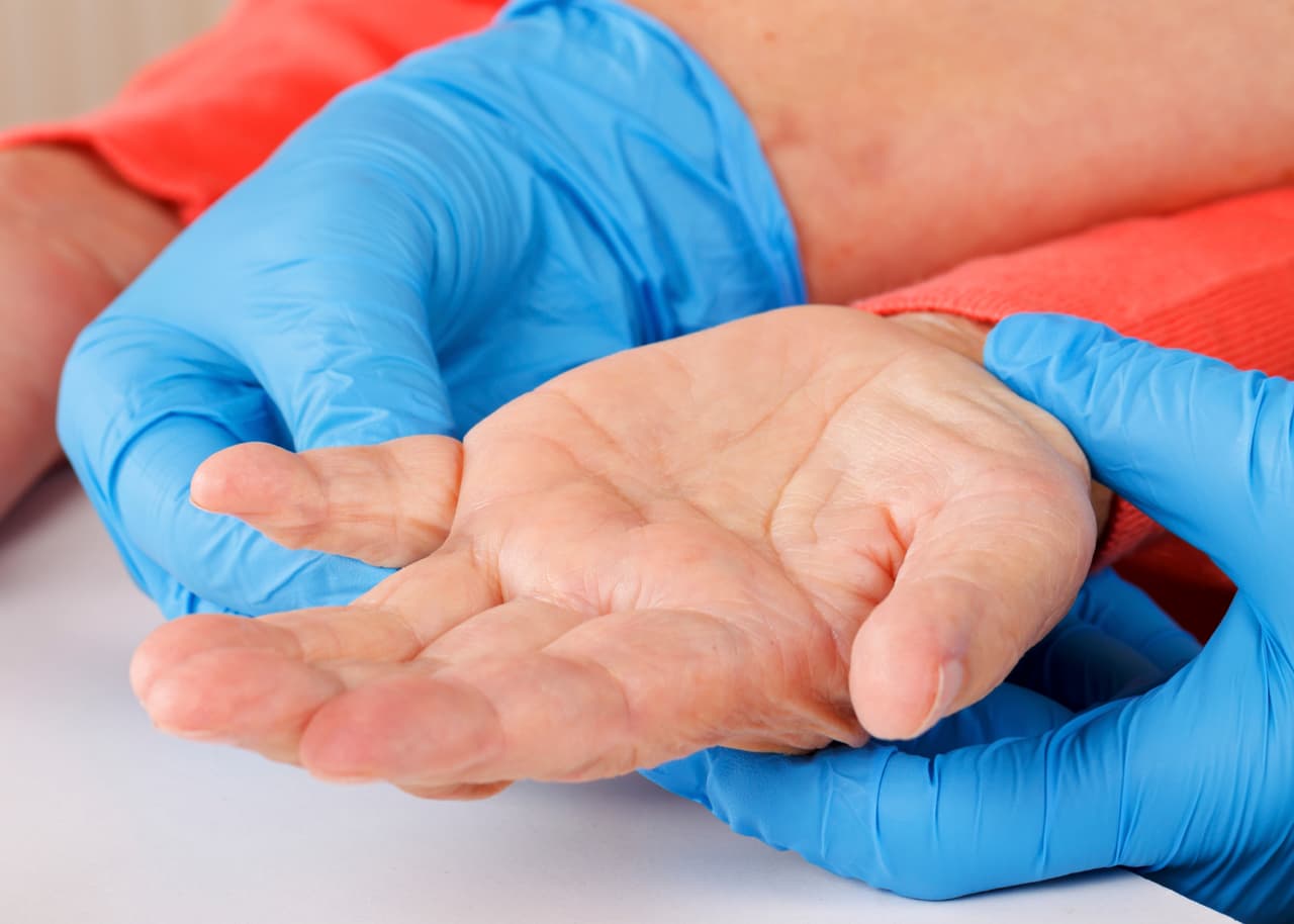 Un procedimiento no invasivo promete disminuir los temblores de las extremidades.