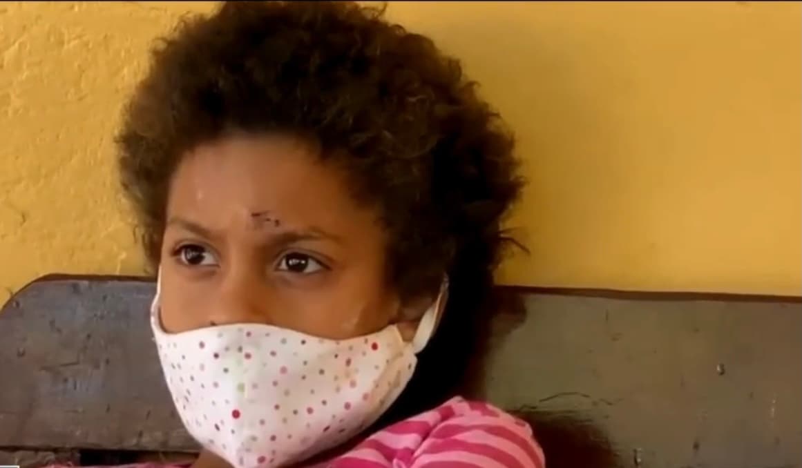 A sus 8 años, Valeria ya tiene cicatrices en su frente y rodillas debido a las fuertes caídas sufridas por las dificultades que está presentando para caminar. “Se me parte el alma, es tan chiquita”, dice Ana sobre su pequeña. 
<br>