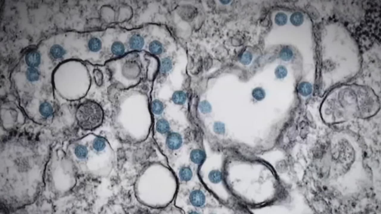 Los CDC se retractan tras afirmar que el coronavirus se transmite por aire