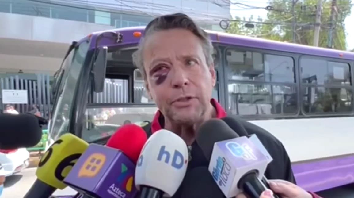 Alfredo Adame podría perder la visión tras la brutal golpiza que recibió: "Las lesiones son de gravedad"