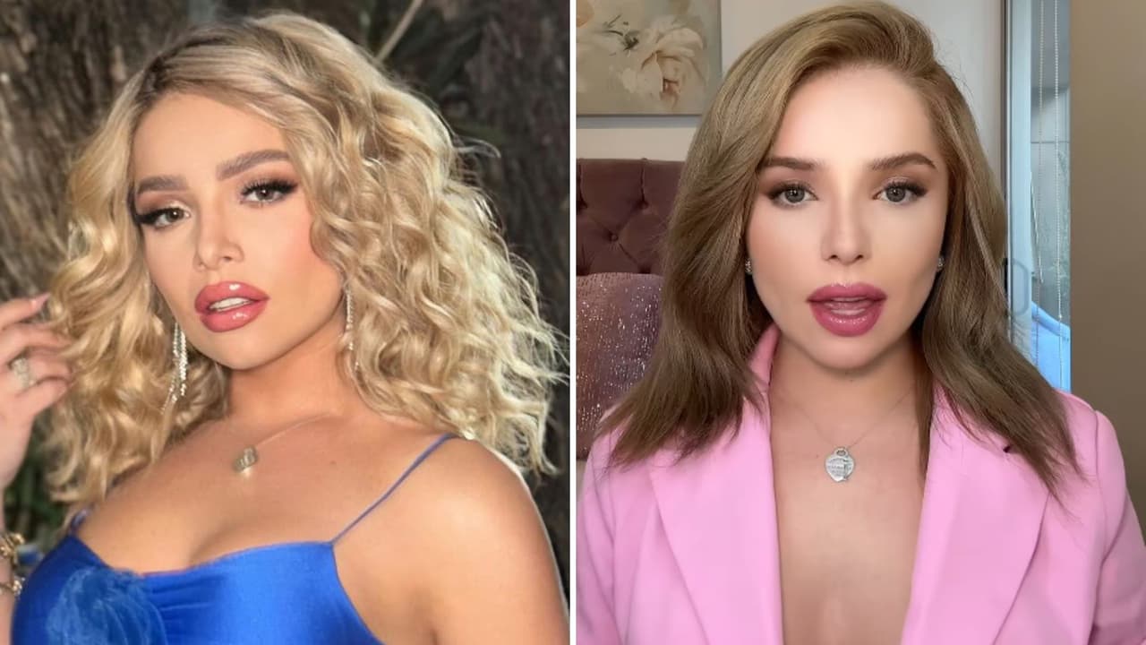 A la izquierda antes de la operación / A la derecha después de la operación.