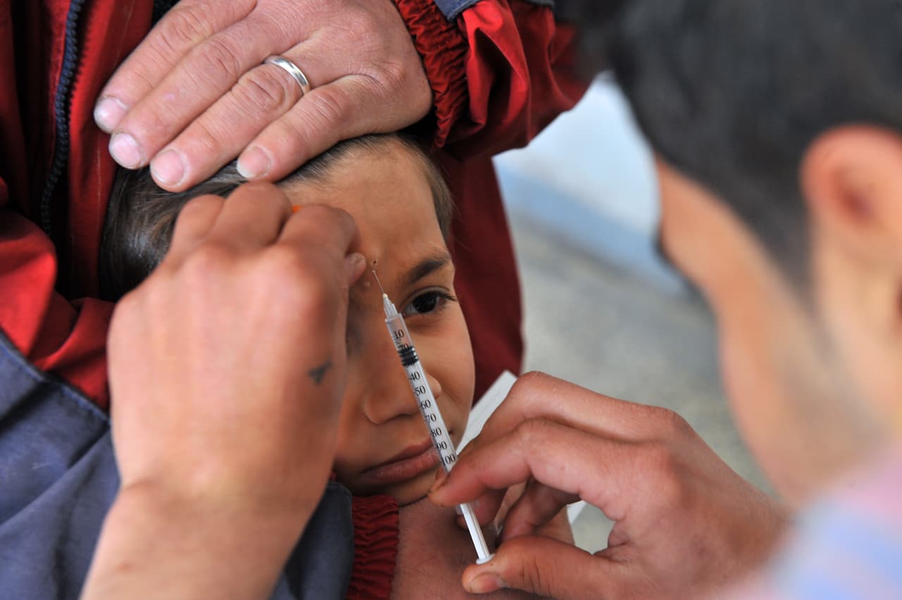 En las Américas se registran más de 51.000 casos de Leishmaniasis, que en su forma cutánea produce cicatrices desfigurantes y discapacidad.