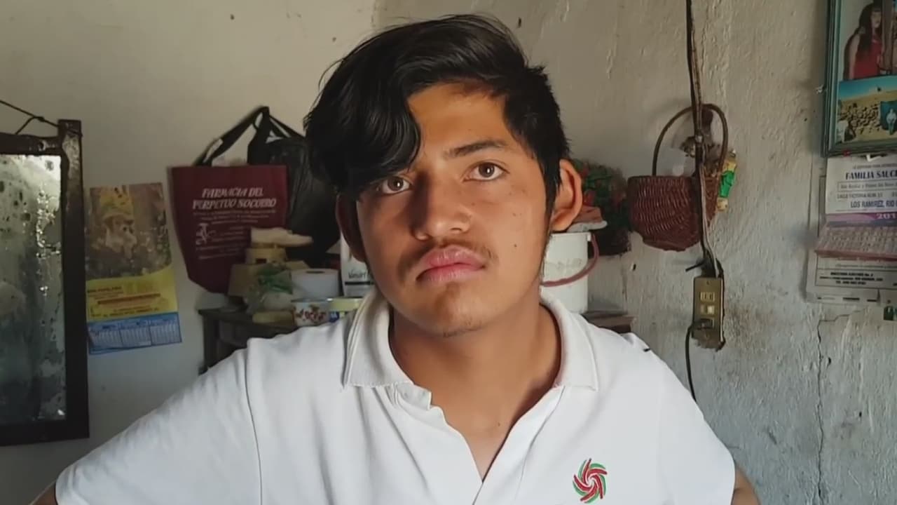 Joven mexicano necesita una operación que lo libere de vivir con un pañal pegado al vientre