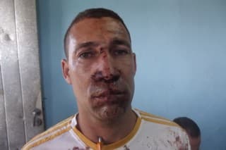 Yriade Hernández Aguilera fuertemente golpeado.