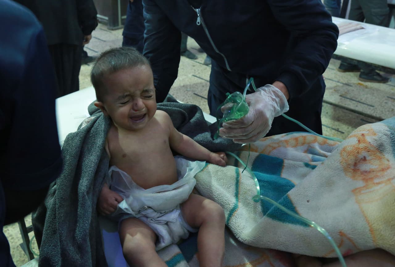 25 de febrero. Un bebé recibe tratamiento luego de un presunto ataque químico en la aldea de al-Shifuniyah. Un niño murió y muchas otras personas (entre 14 y 17) sufrieron dificultades respiratorias luego de un presunto ataque químico.