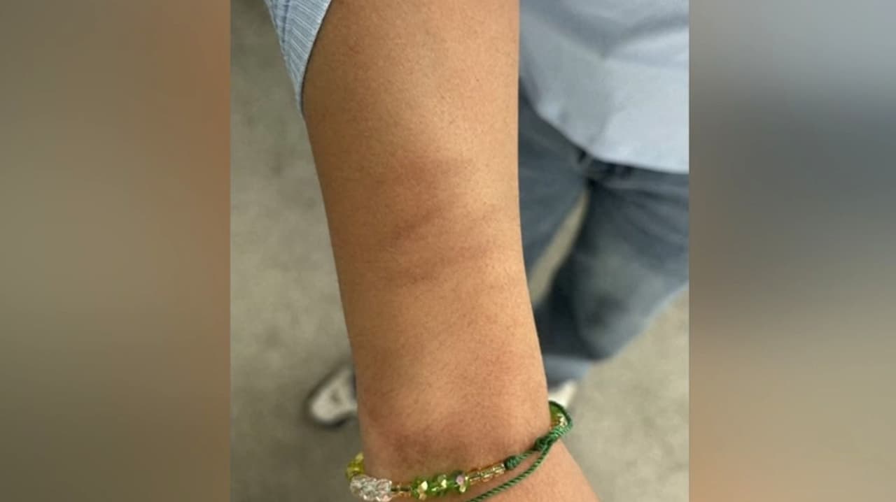 "Me agarraron del cuello y me ahorcaron": Familias hispanas narran operativos con uso excesivo de la fuerza