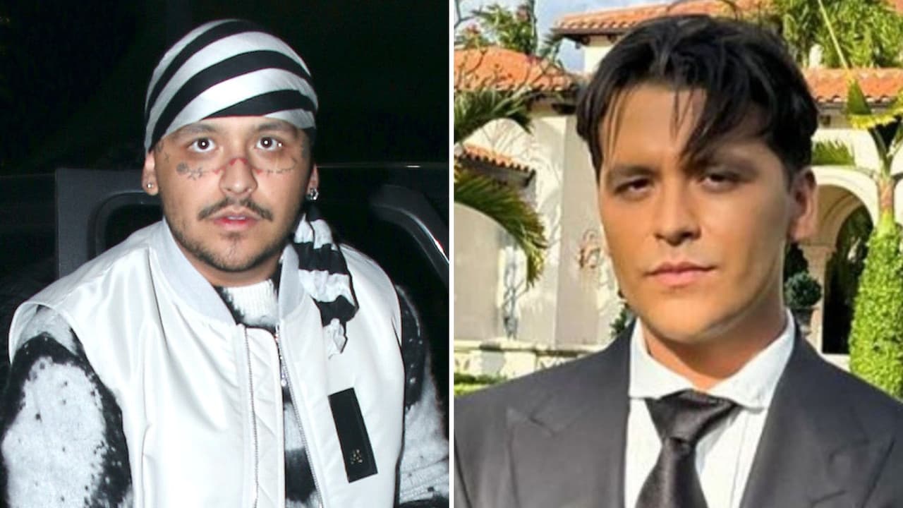 Nodal reveló que lleva tres sesiones para quitarse los tatuajes del rostro.