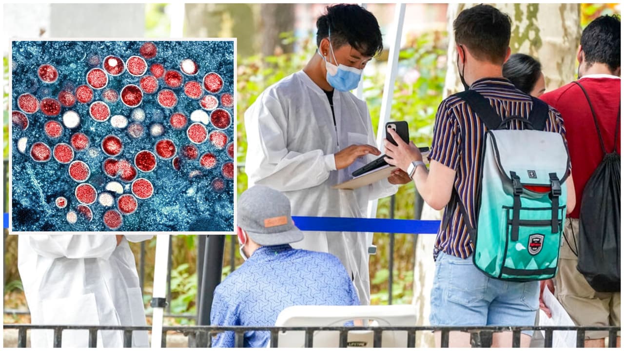 La ciudad de Nueva York declara la viruela del mono una emergencia de salud pública