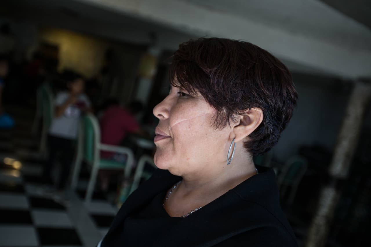 Cristina, de 38 años, fue víctima de múltiples agresiones por parte de su último marido en Guatemala, de quien se separó y por quien huyó con sus hijos: 
<b>"Él me quitó la tranquilidad, no tenía paz en ningún lugar"</b>, dice. El lado izquierdo de su rostro muestra una de las cicatrices que él le dejó tras atacarla con un machete. Como consecuencia de esa agresión, Cristina tiene una parálisis parcial en el lado izquierdo de su cara. "Él no sabe que vamos de regreso", dice.
<br>