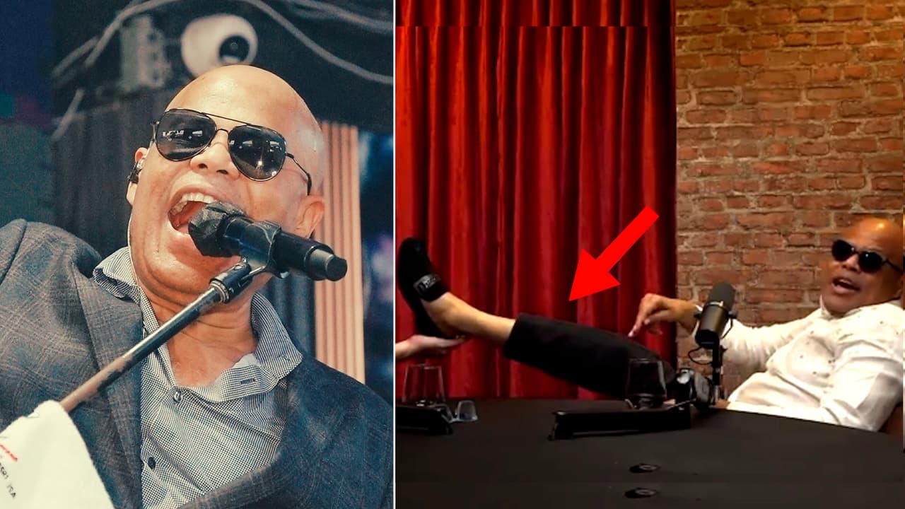 ¿Rubby Pérez tenía una prótesis en la pierna? El mismo cantante lo aclaró