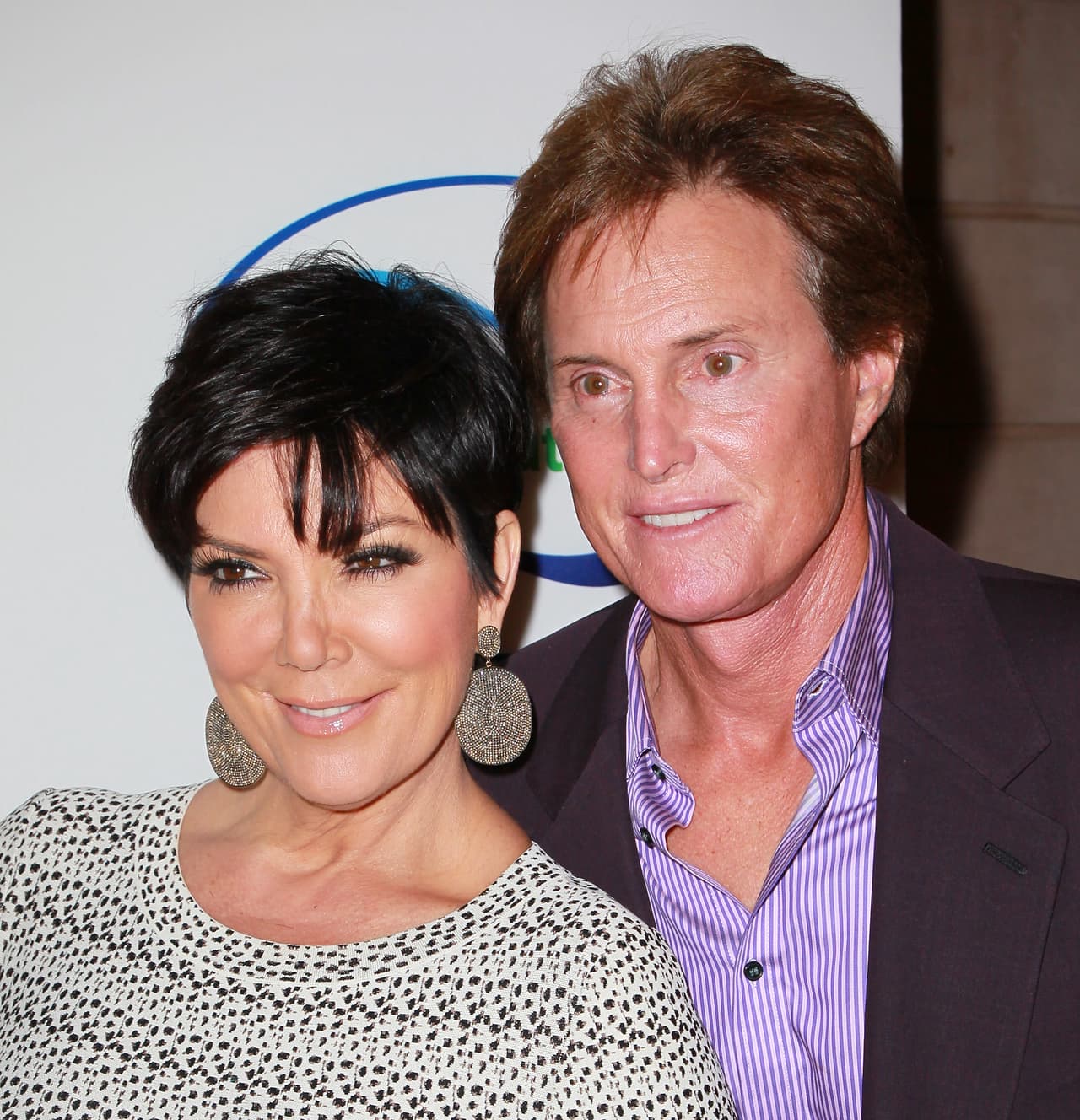 Ya comprobaremos pronto si en realidad Bruce se operó o todavía falta.