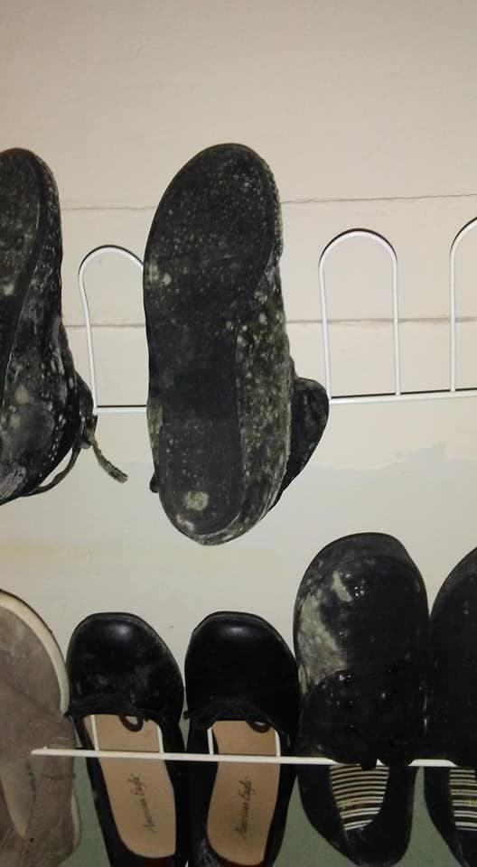 Hongo y moho en zapatos