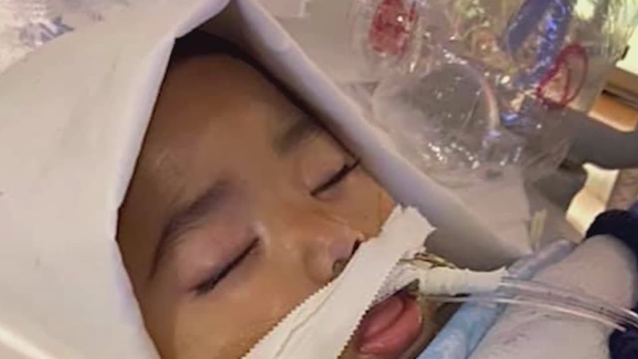 "El corazón del bebé poquito a poquito se apagó": Doctor habla sobre las últimas horas de Nick 