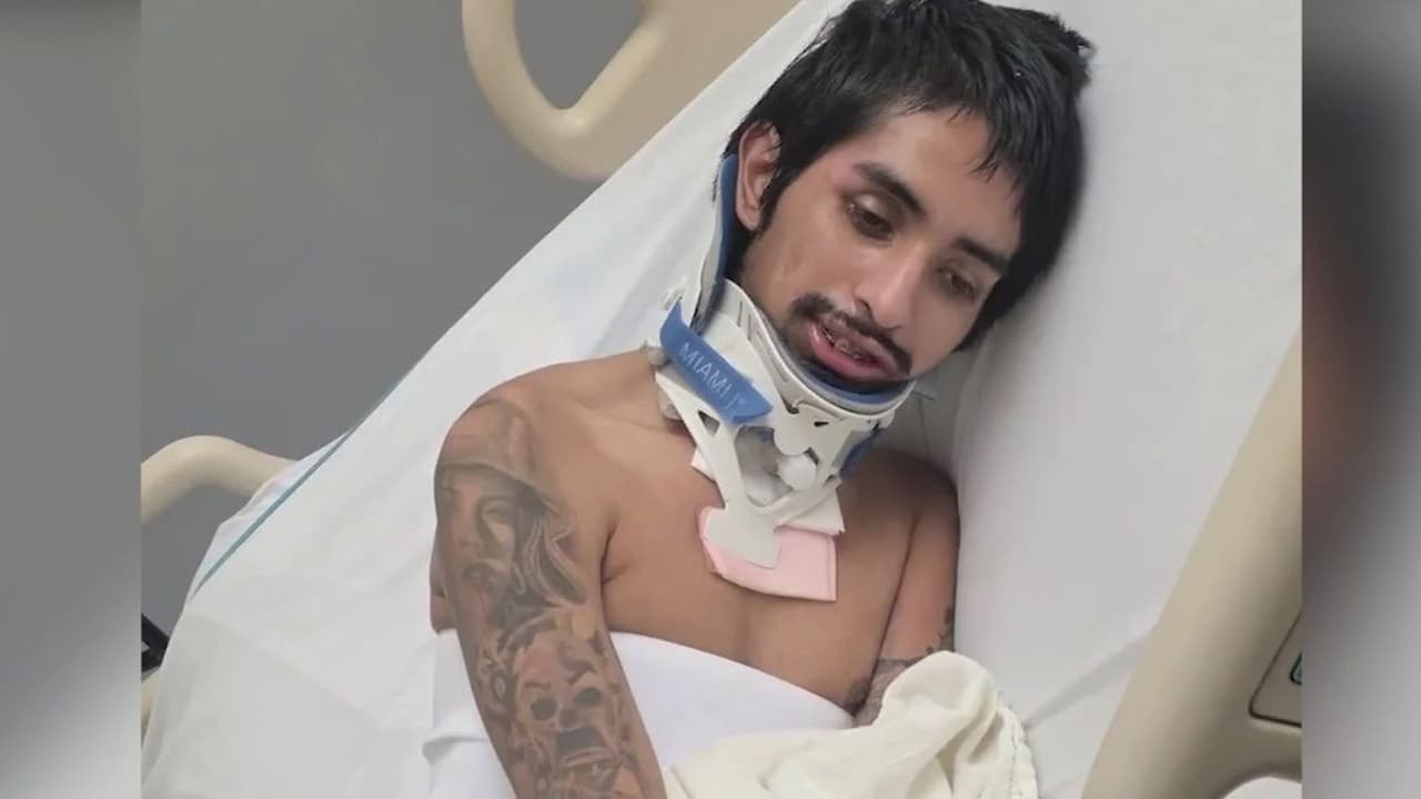 Familia en México lucha por la repatriación de joven atropellado en Arizona; necesita cuidados especiales