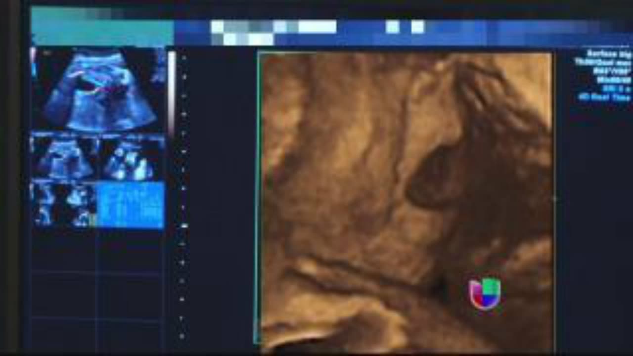 Así se vio baby Kamilia en la barriguita de su mami.