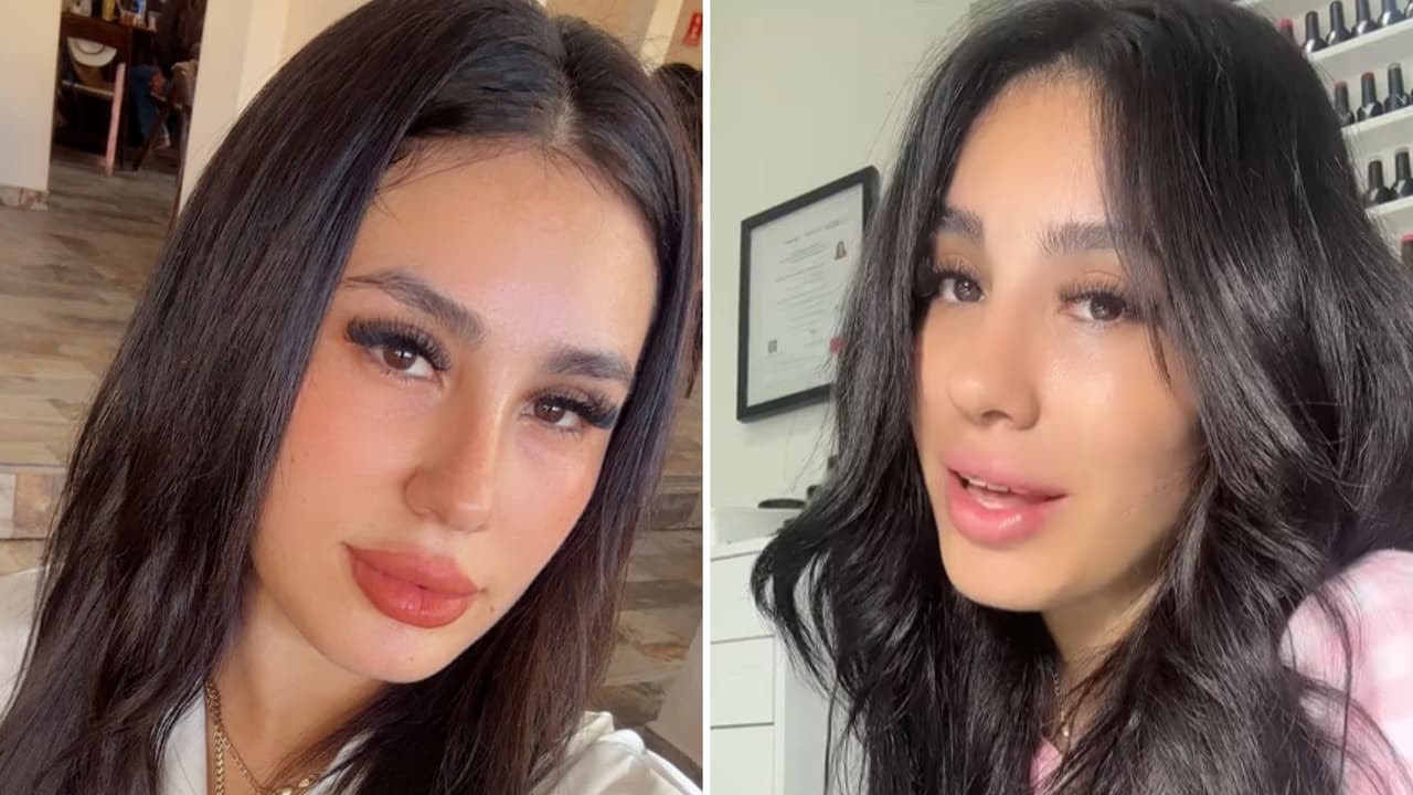 Muere influencer Asli Fernández tras cirugía plástica: su viudo pide “justicia”