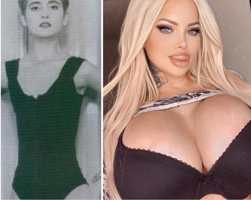 A finales de enero pasado, publicó una foto comparativa en la que aparece en una imagen de su juventud, 
<b><a href="https://www.instagram.com/p/CKkQIGwhEVS/?utm_source=ig_embed&ig_rid=8ef76097-33de-48b9-a2bc-a70268c5156c" target="_blank">cuando aún no tenía operaciones,</a></b> y una actual. Ante esto, la argentina ha sido objeto de duras críticas por su aspecto y transformación. 
<br>