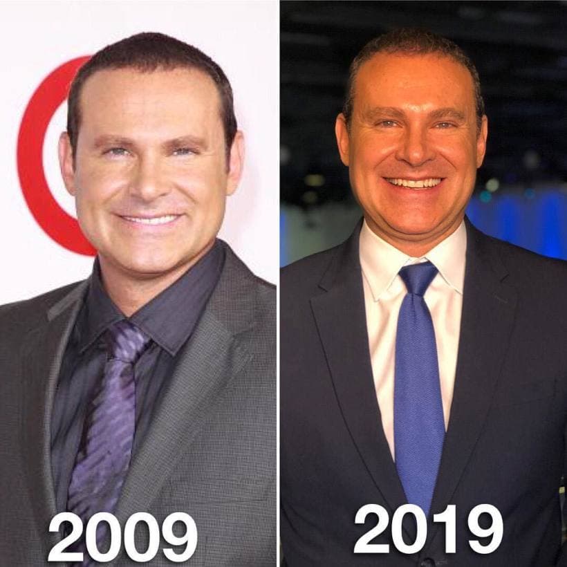 El conductor mexicano no tiene complejos, y el mismo ha hablado de los trucos de belleza que ha utilizado para verse y sentirse bien. "Soy un conejillo de indias, que transplante, que las cejas... me he hecho de todo", explicó entre risas el conductor mexicano durante una transmisión del show.