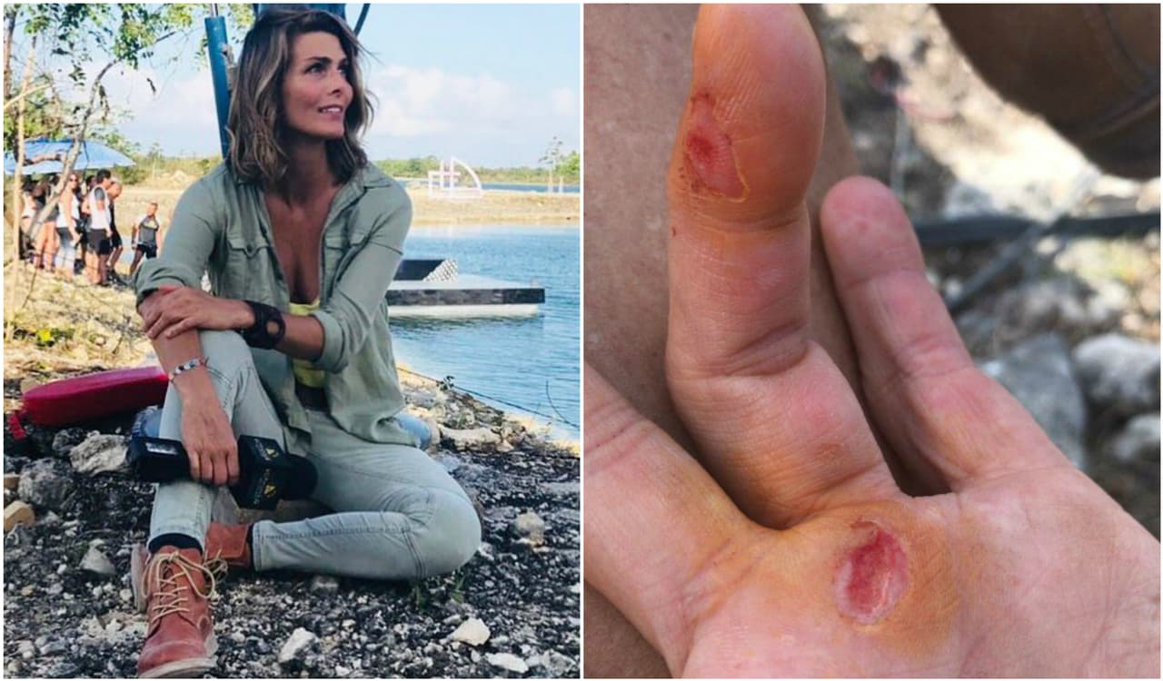 Una de ellas fue Montserrat Oliver, quien se aventuró a utilzar la pista de aire de una de las pruebas y terminó con la mano izquierda lastimada. A través de una historia en Instagram, la conductora mandó un mensaje: "Esto pasa por jugar en la gran pista de aire”.