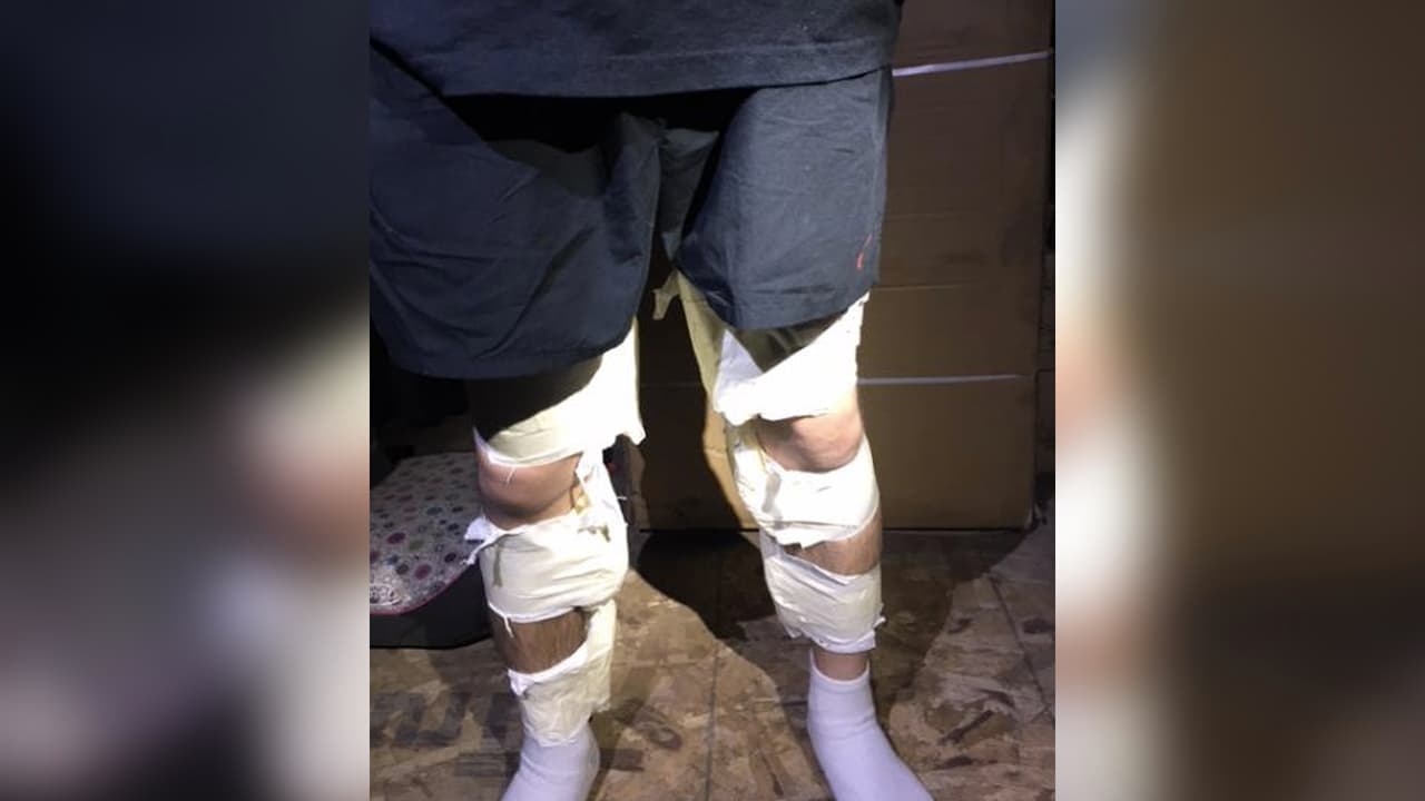 Agentes fronterizos de Arizona arrestaron a un hombre que traía una carga de metanfetamina pegada a sus piernas