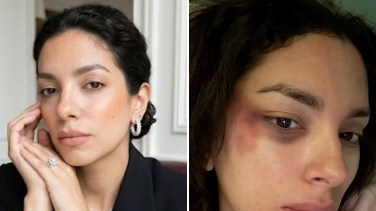 Muere ‘influencer’ Marie Claire González tras denunciar abuso: “¡Me rompiste! ¡Me apagaste!" 