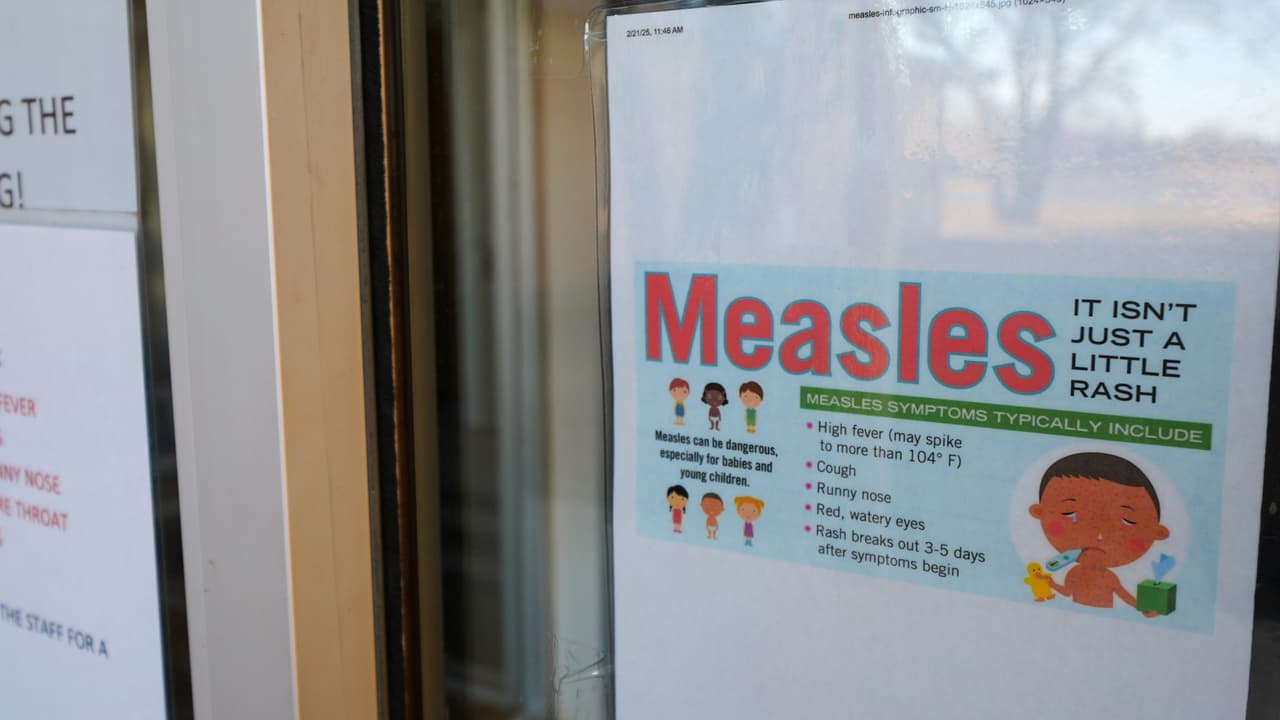 Maryland confirma caso de sarampión y detalla lugares de posible exposición
