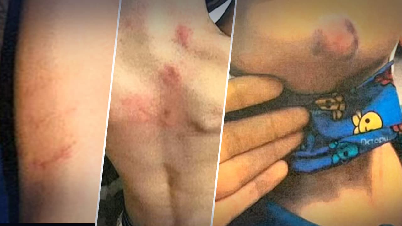  Familia hispana demanda por maltrato que su hijo de 7 años con autismo sufrió en la escuela