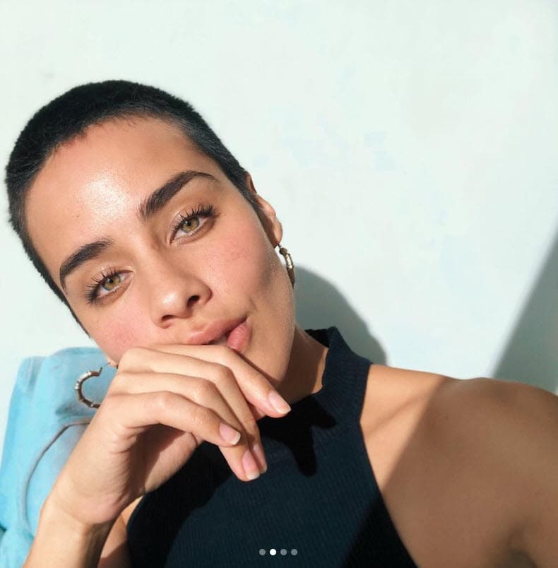 Incluso, compartió que perdió algunos trabajos en la actuación por 
<b>las marcas en su cuerpo.</b>
<br>
<br>