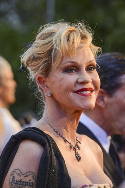 La actriz ha sufrido de tener piel muy delicada y poco firme por lo que recurrió a las inyecciones de botox, pero no obtuvo un resultado favorecedor.