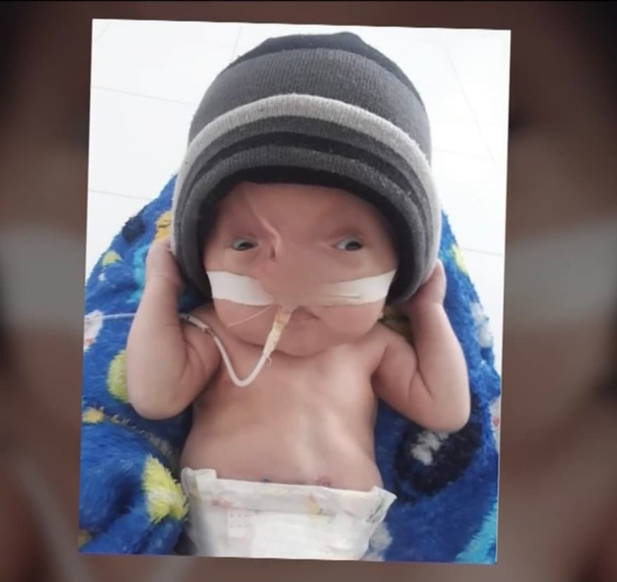 Con el tiempo, Jaimy no solo decidió compartir su 
<a href="https://www.univision.com/temas/amor">amor</a> inconmensurable hacia Emiliano, sino que vio con gusto como comenzaba a crecer, mientras lo alimentaba todos los días con sonda. 
<b>“Hace cosas de un niño de seis meses”, dice con angustia, pero agradecida con toda la gente que la ha ayudado pero consciente que falta mucho. </b>
<br>