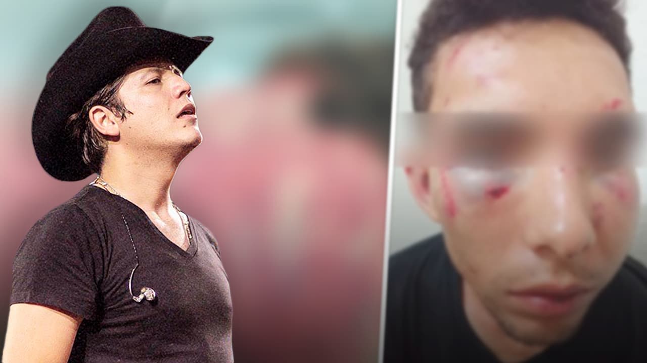 Denuncian a Remmy Valenzuela tras brutal agresión en contra de su primo y su novia