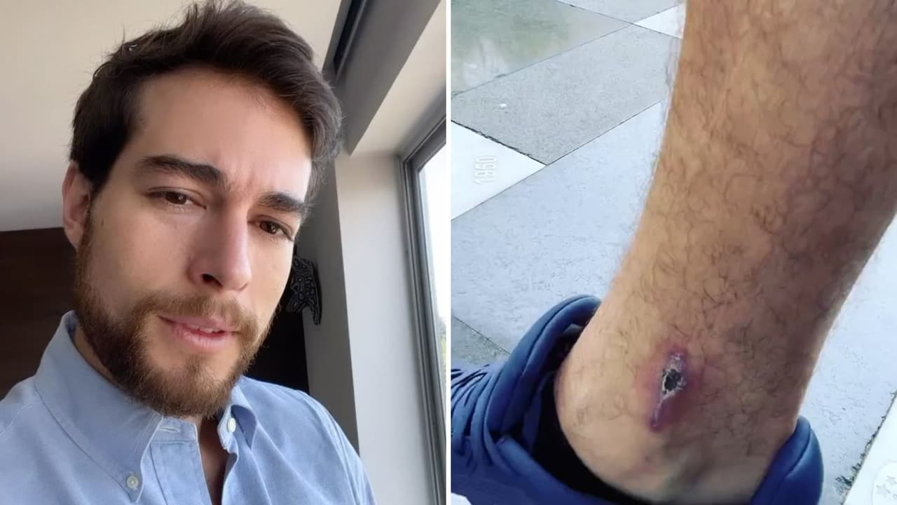 Danilo Carrera cuenta cómo está su salud a casi dos meses de haber sido atropellado